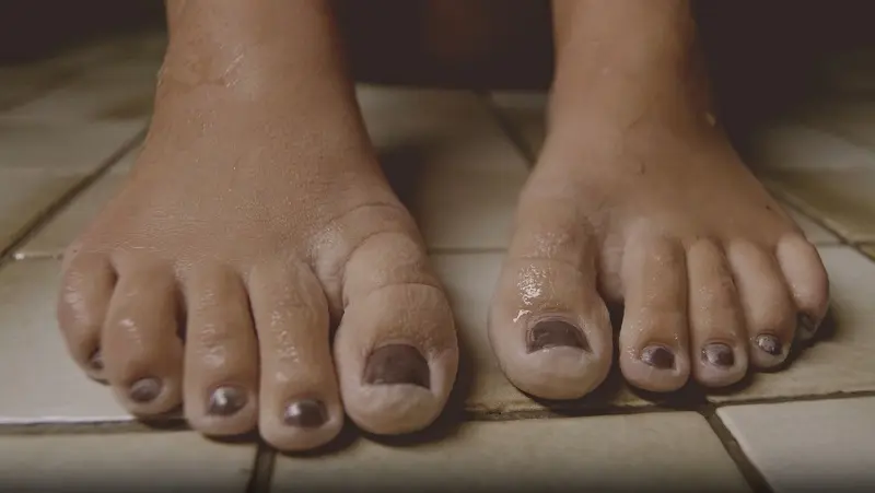 Conseils et astuces pour traiter les Mycoses des ongles de pieds